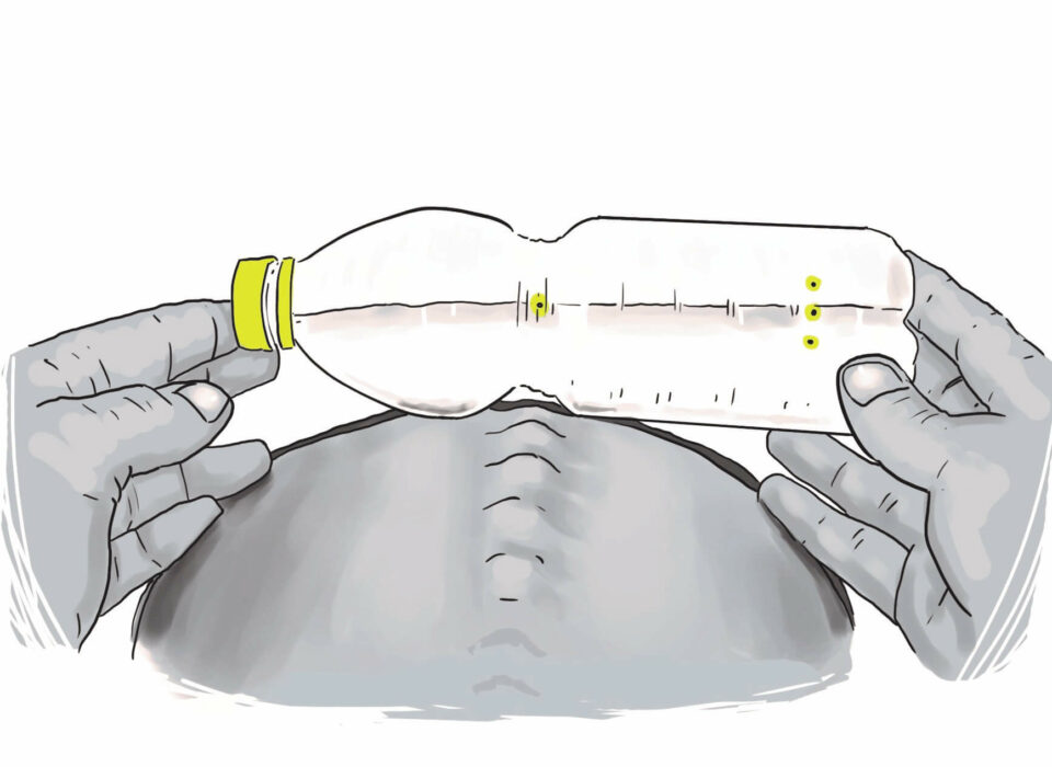 Jak samodzielnie kontrolować skoliozę - torsion bottle